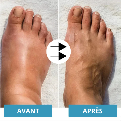 Masseur de pieds EMS